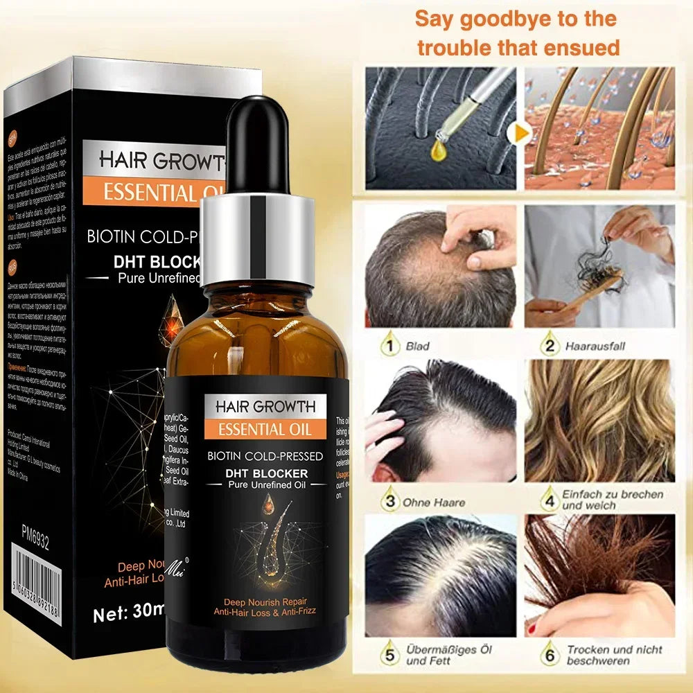 Hair Growth Essential Oil™ - Óleo de Crescimento Capilar | Ultimas Unidades